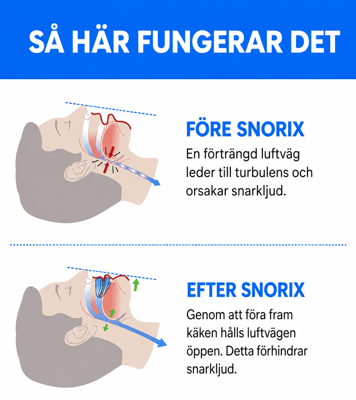 Snorix – Låt sömnen fortsätta. Inte snarkningen
