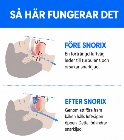 Snorix – Låt sömnen fortsätta. Inte snarkningen